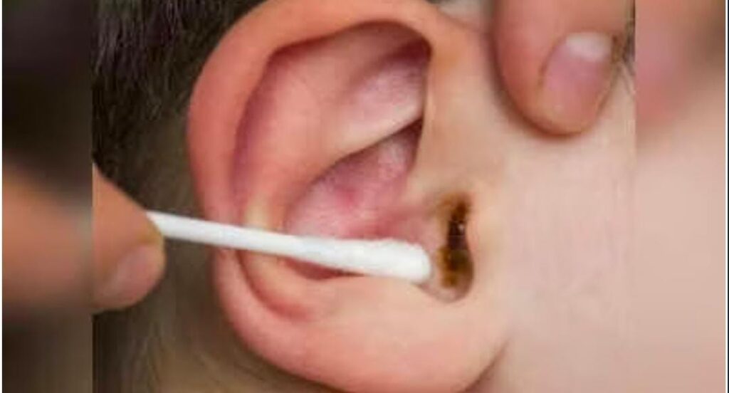 ಕಿವಿ ನೋವು ಬಂದರೆ ಏನು ಮಾಡಬೇಕು..?