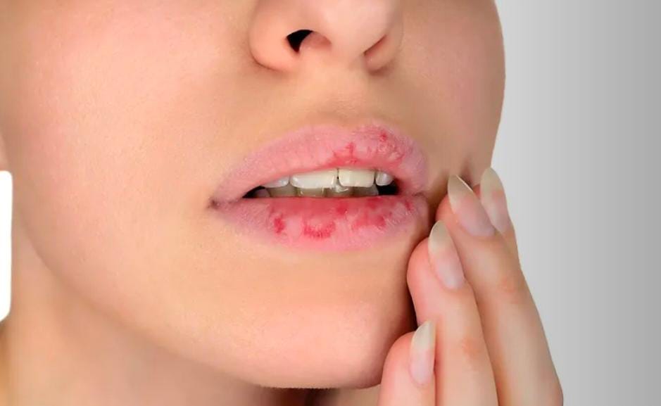 ಲಿಪ್ಸ್ಟಿಕ್ ಬಳಸುವುದರಿಂದ ನಿಮ್ಮ ತುಟಿಗಳಿಗಾಗುವ ಹಾನಿಗಳು