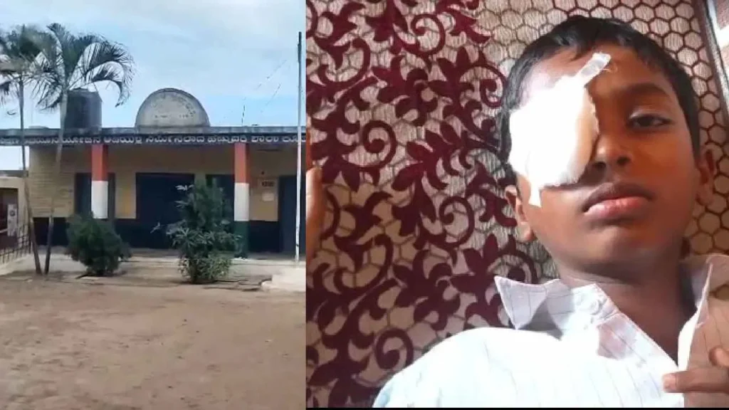 ಪೆನ್ನು ವಿಚಾರಕ್ಕೆ ಜಗಳ: 5ನೇ ಕ್ಲಾಸ್ ವಿದ್ಯಾರ್ಥಿಯ ಕಣ್ಣುಗುಡ್ಡೆಯನ್ನೇ ಕಿತ್ತ 1ನೇ ತರಗತಿ ವಿದ್ಯಾರ್ಥಿ!